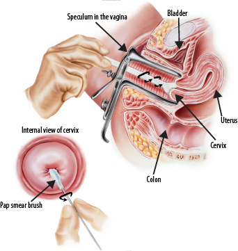 Before A Pelvic Exam